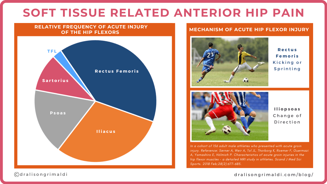 Acute Hip Flexor Injuries_dralisongrimaldi blog graphic 169