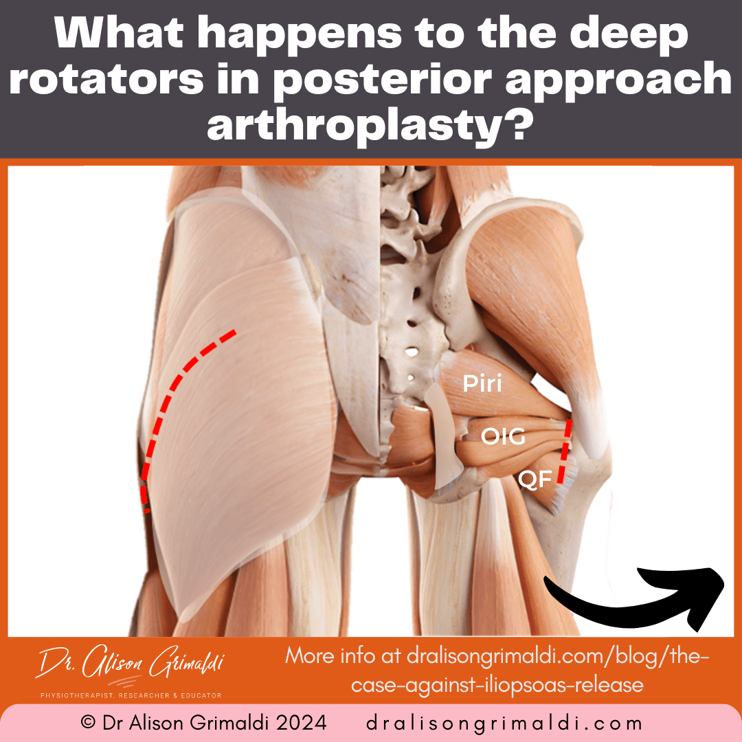 what-happens-to-the-deep-rotators-in-posterior-approach-arthroplasty