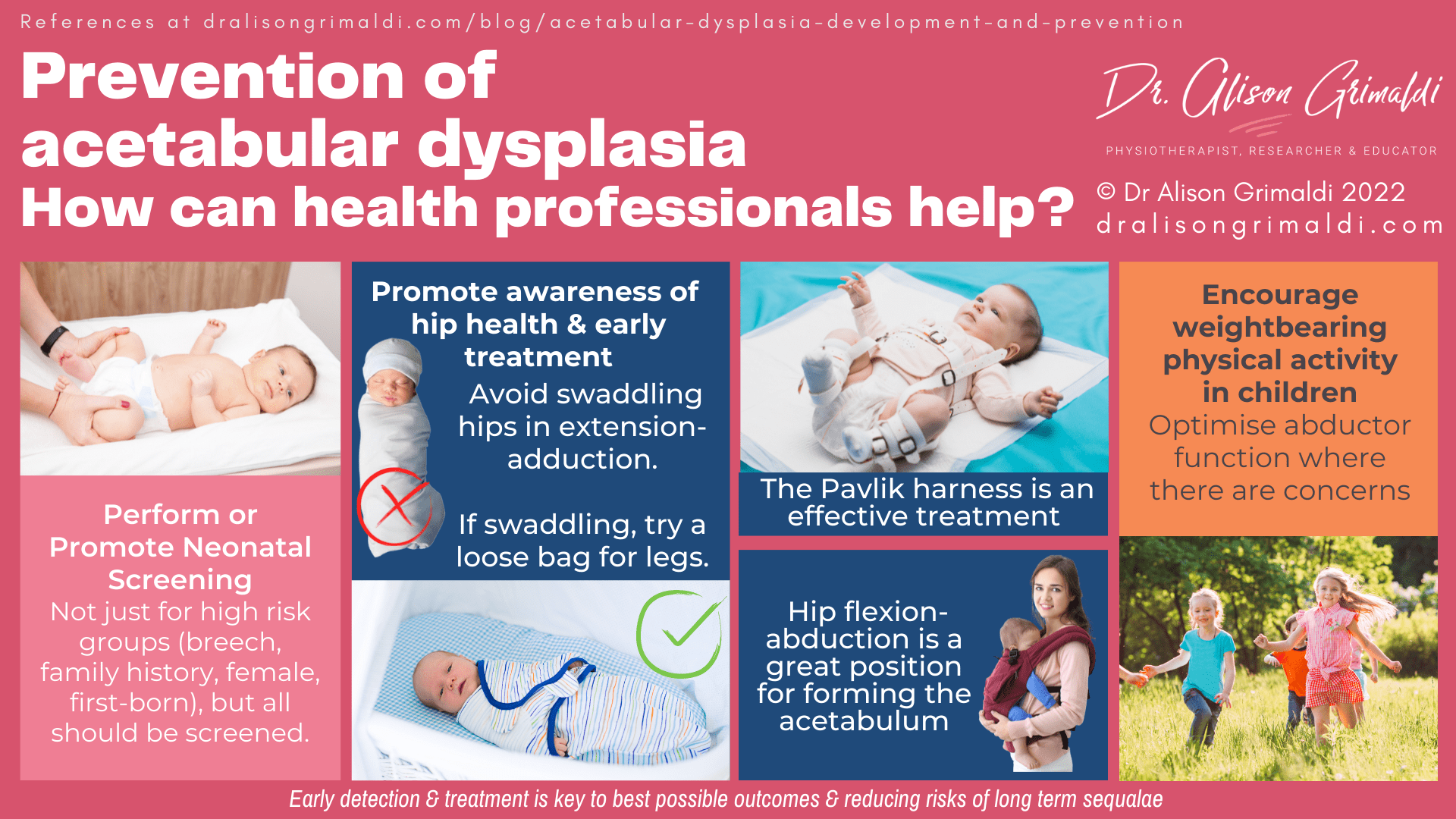 The relationship between physical activity, femoral neck-shaft angle & dysplasia