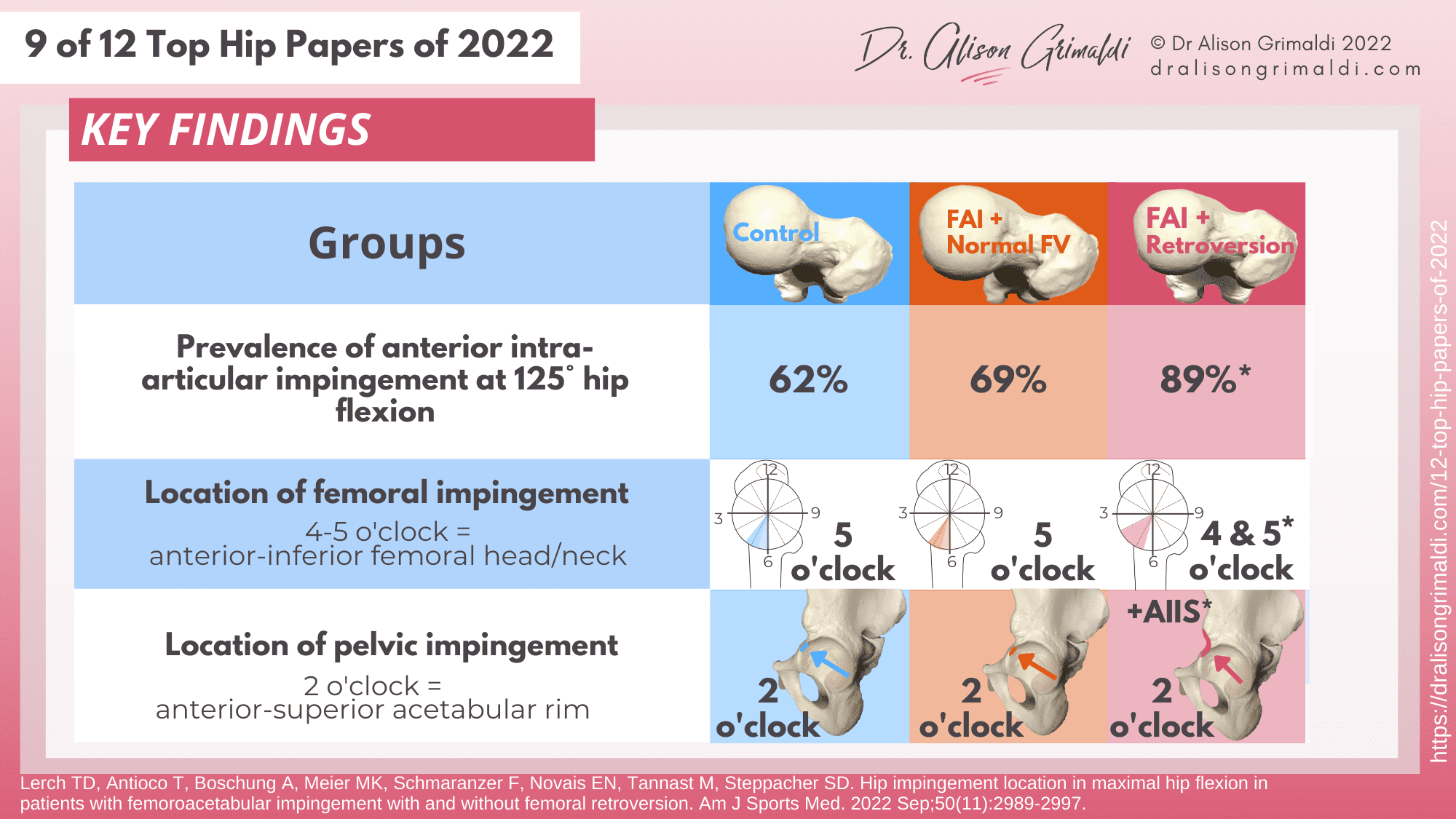 Key Findings - 9 of 12 - FAIS, femoroacetabular impingement, femoroacetabular impingement, femoral malversion