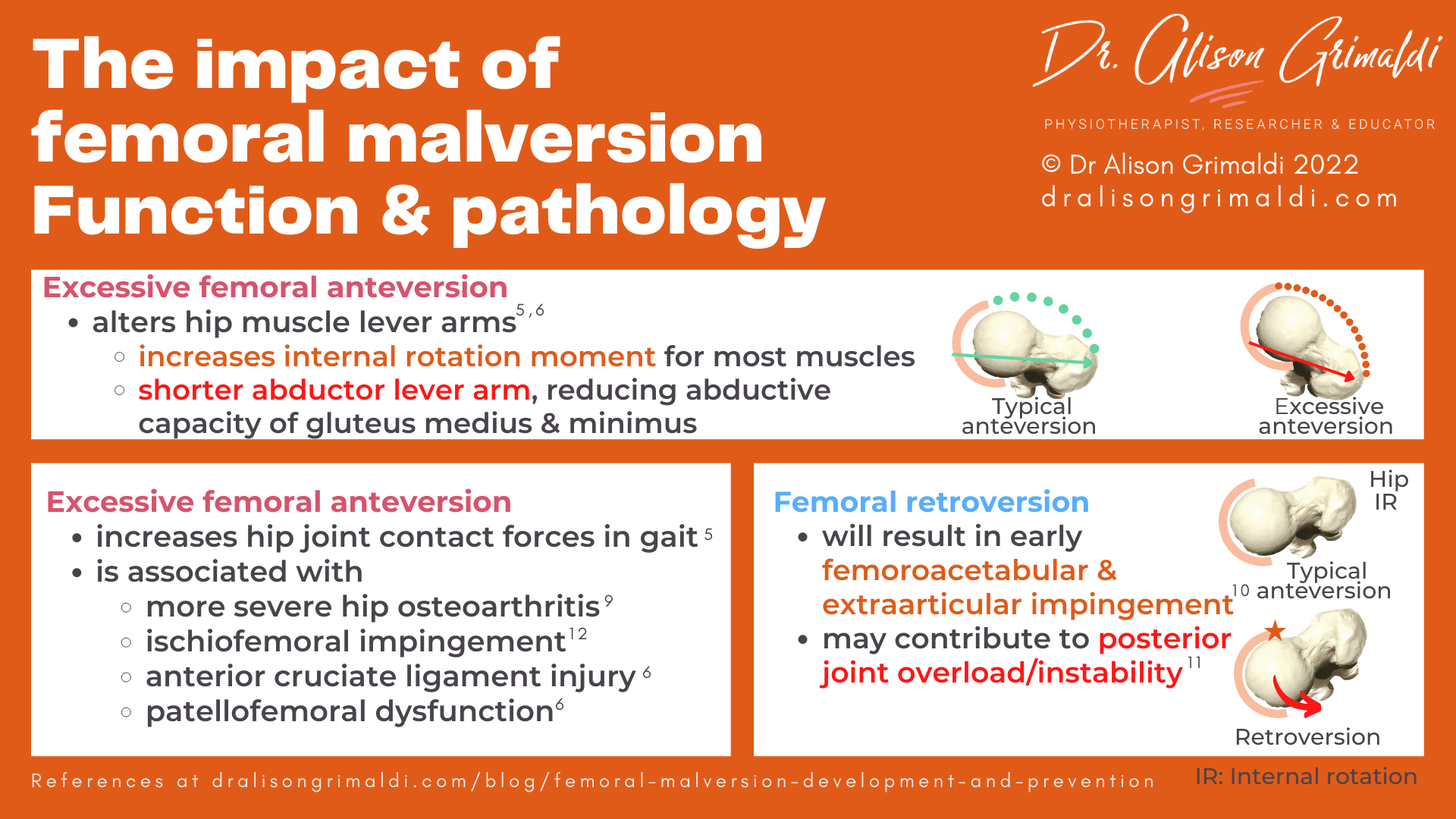 Normal femoral version & femoral malversion