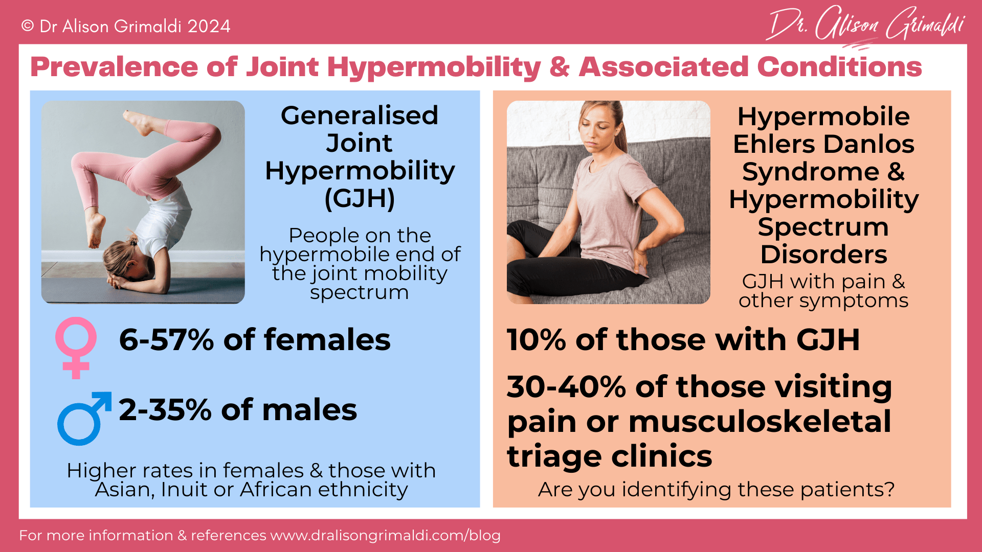 Prevalence-of-Joint-Hypermobility-&-Associated-Conditions