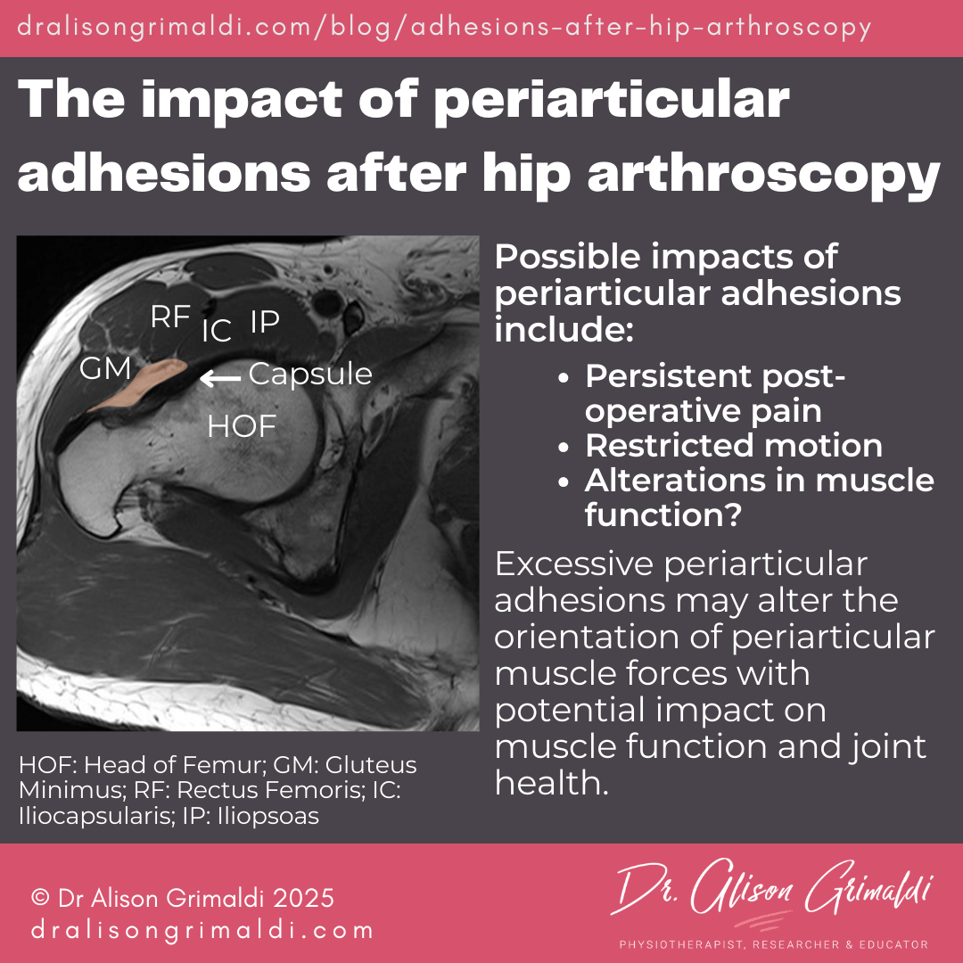 The-impact-of-periarticular-adhesions-after-hip-arthroscopy