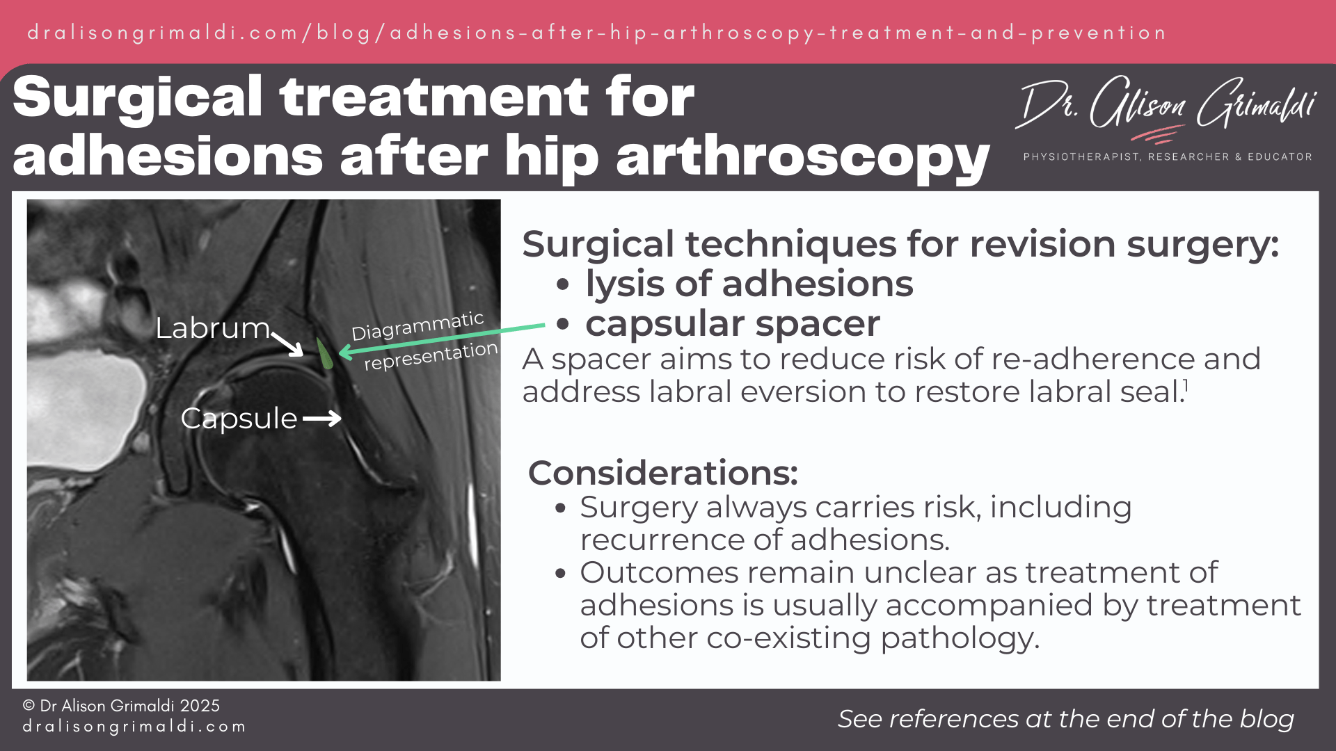 surgical-treatment-for-adhesions-after-hip-arthroscopy