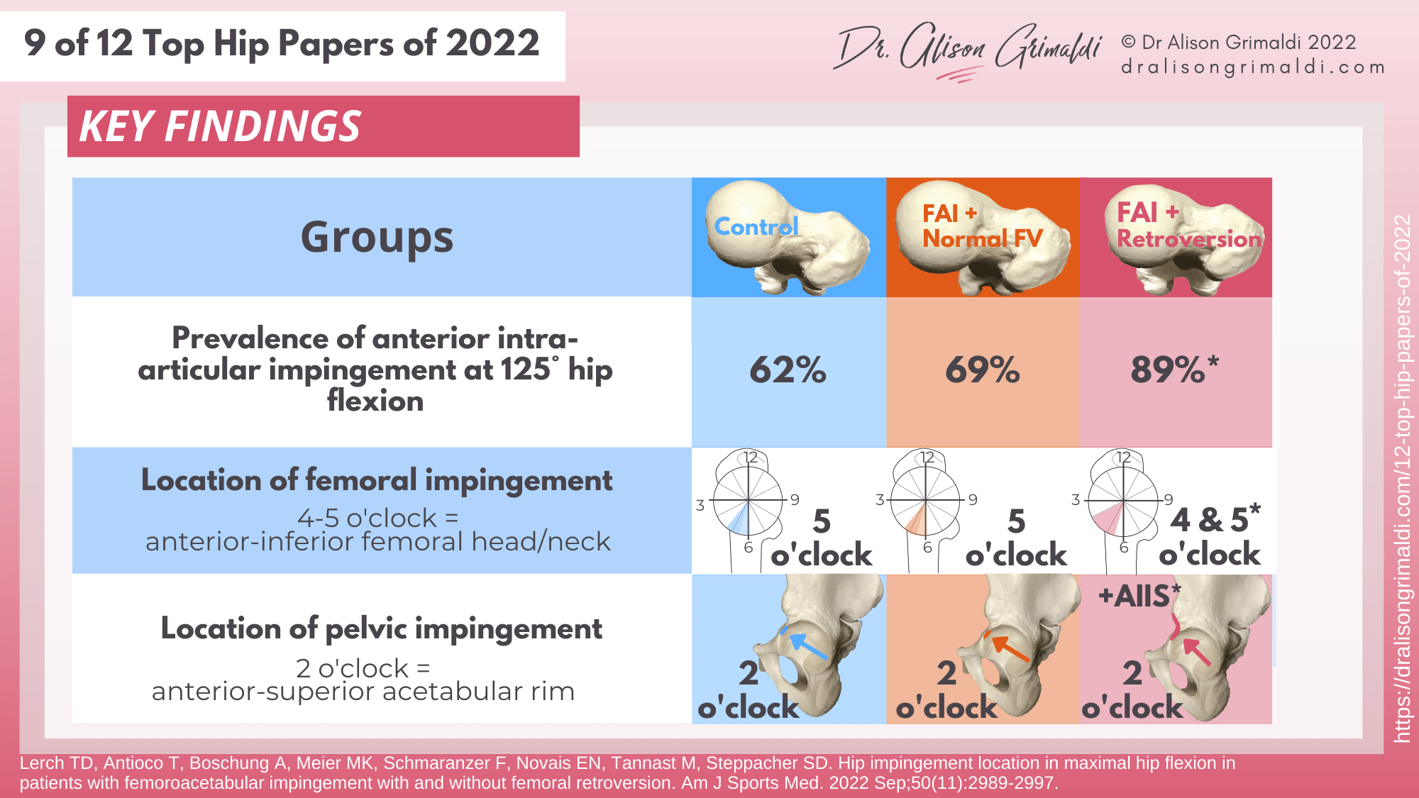 Key Findings - 9 of 12 - FAIS, femoroacetabular impingement, femoroacetabular impingement, femoral malversion