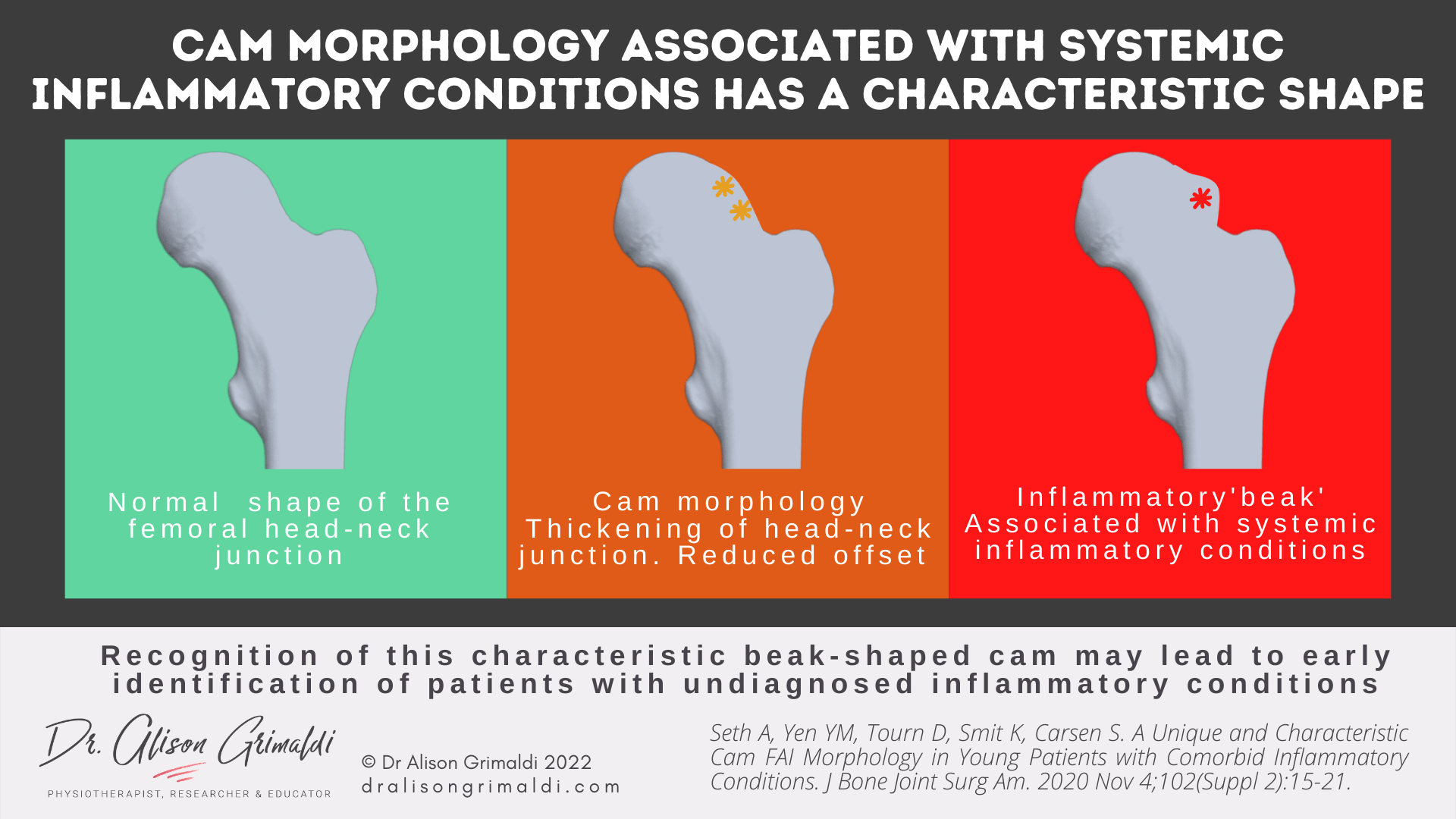 Pistol Grip vs inflammatory beak