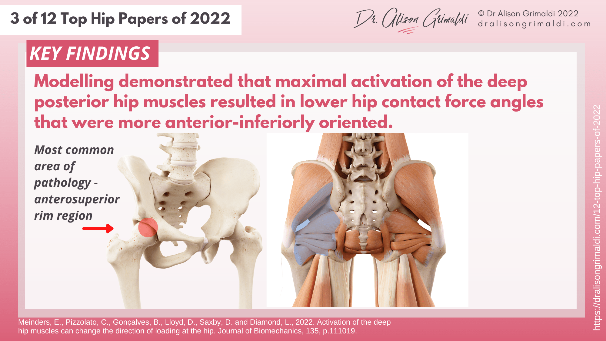 Key Findings - 3 of 12 - deep hip muscles and hip joint loads